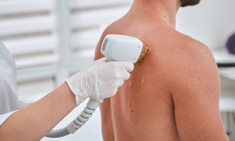Body Laser Hair Removal