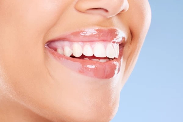 Brighten Your Smile